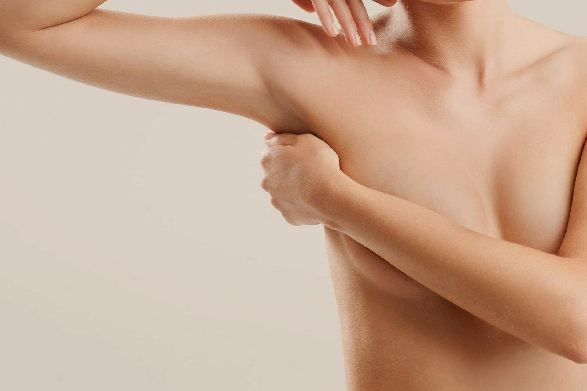Der Hautüberschuss an den Oberarmen stört meist beim Tragen kurzärmeliger Oberteile. Bei der Oberarmstraffung wird in der Operation meist eine Kombinationstherapie aus Liposuktion und Straffung durchgeführt.