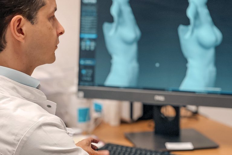 Für Brustvergrößerungen wie -verkleinerungen, aber auch in der Brustrekonstruktion bei Asymmetrien oder nach einer Krebserkrankung kann Professor Schenck ein sehr breites Behandlungsspektrum anbieten.