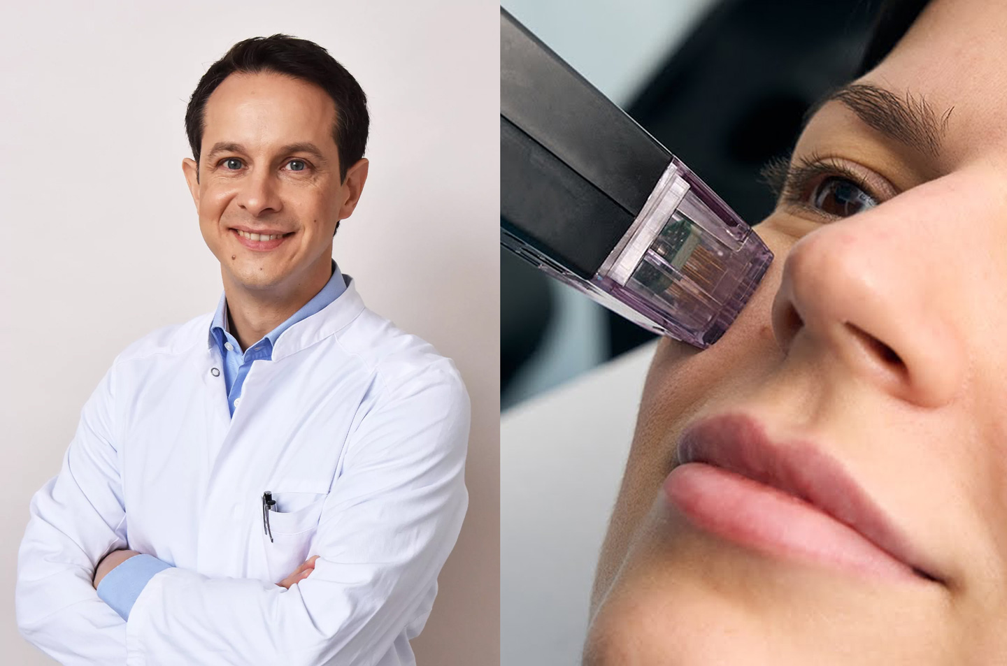 MORPHEUS8™ Behandlung 2 Dr. Schenck