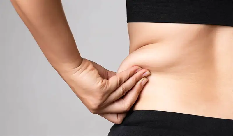 Bauchdeckenstraffung in München 3 Bauchdeckenstraffung Beispiel